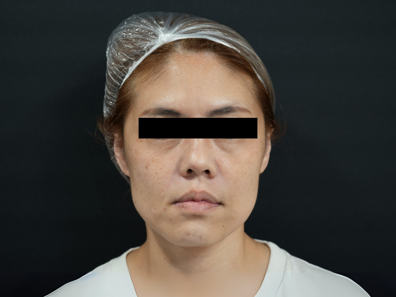 Before image alt