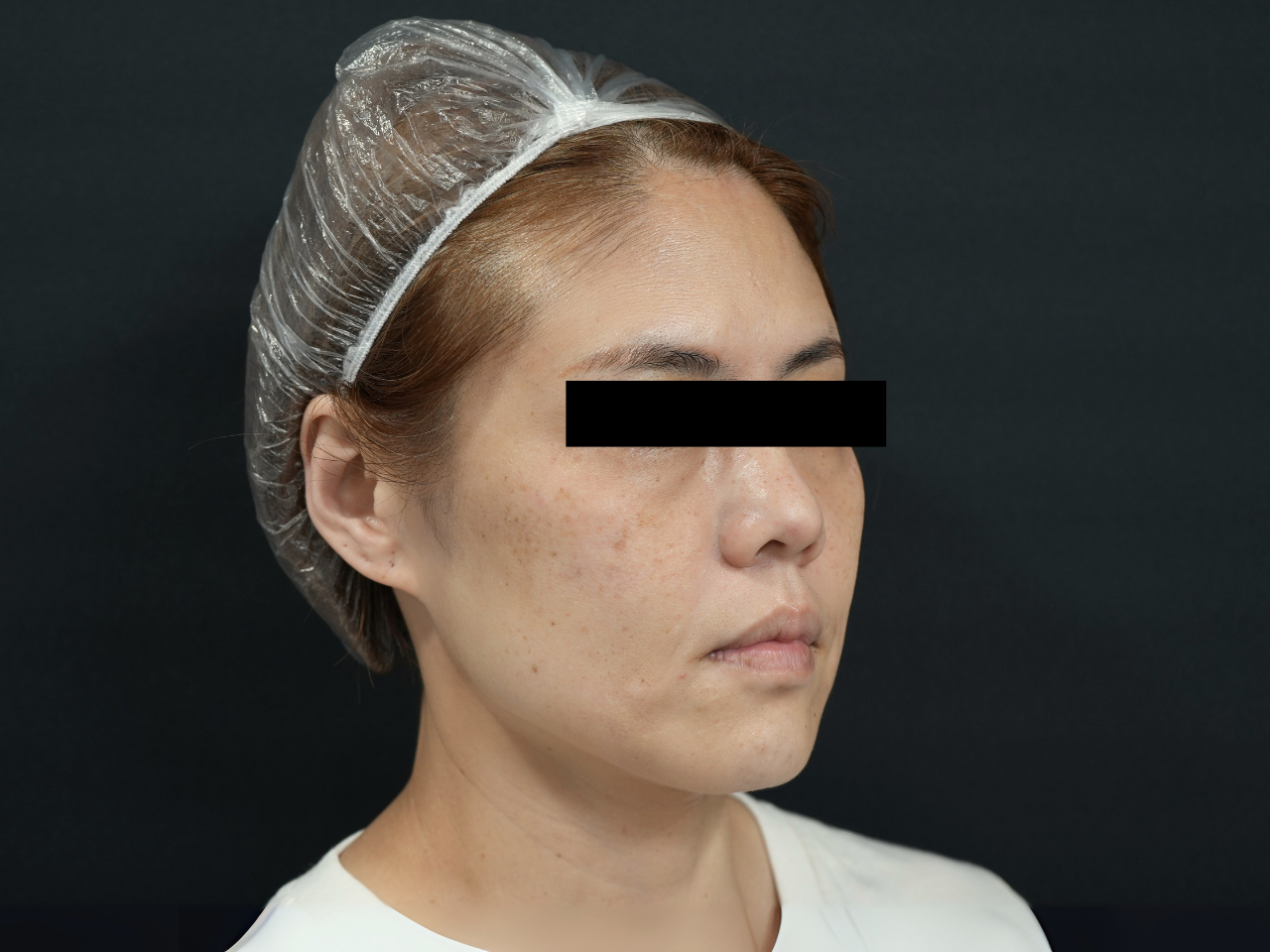 Before image alt