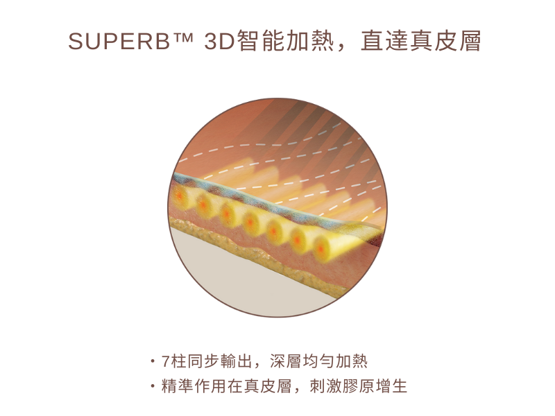 索夫波專利：SUPERB 3D智能加熱