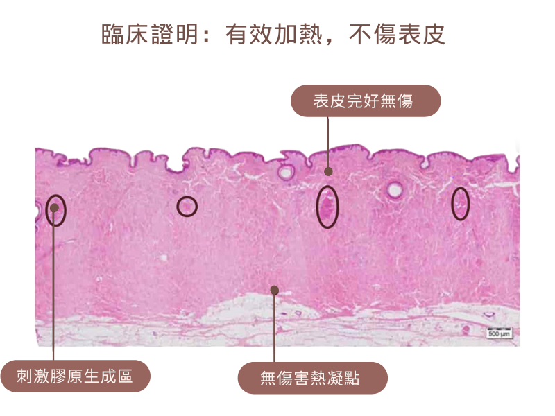 索夫波｜皮膚組織解剖圖