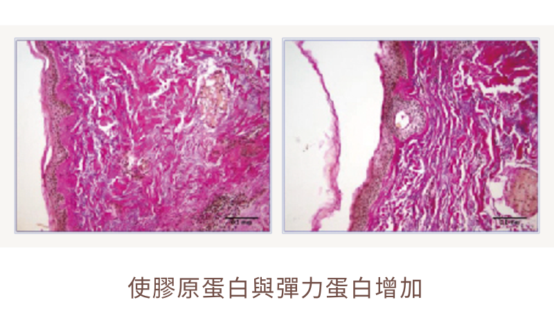 索夫波｜皮膚組織解剖圖