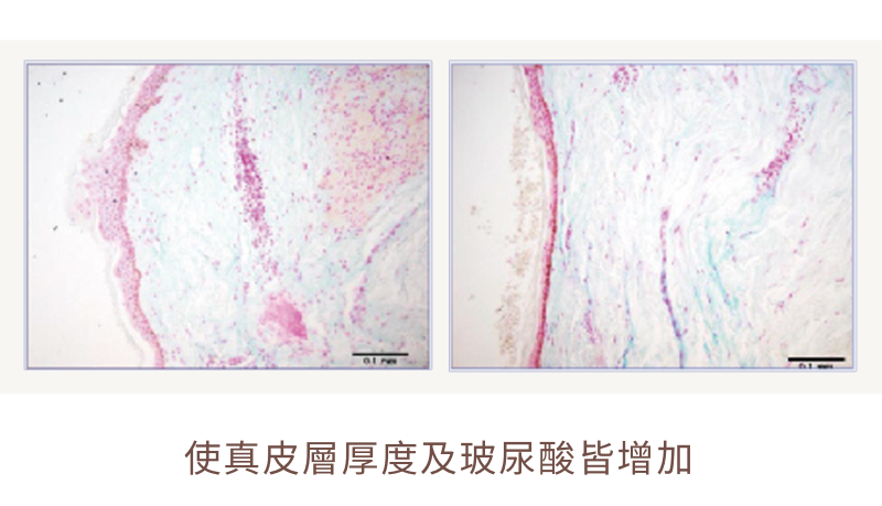 索夫波｜皮膚組織解剖圖