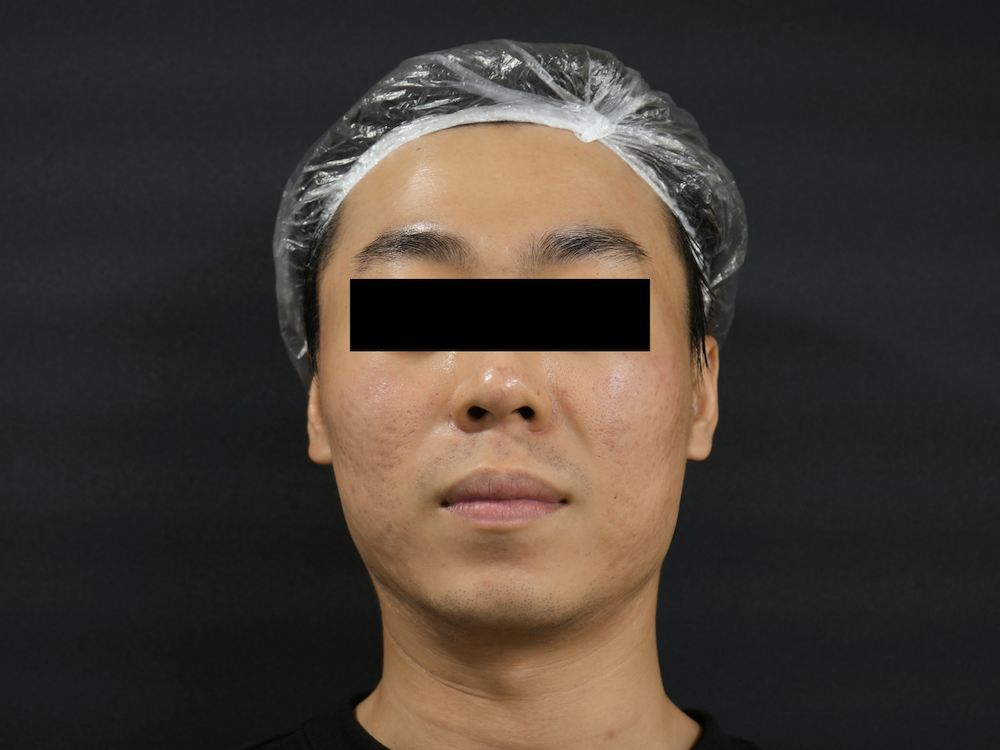 Before image alt