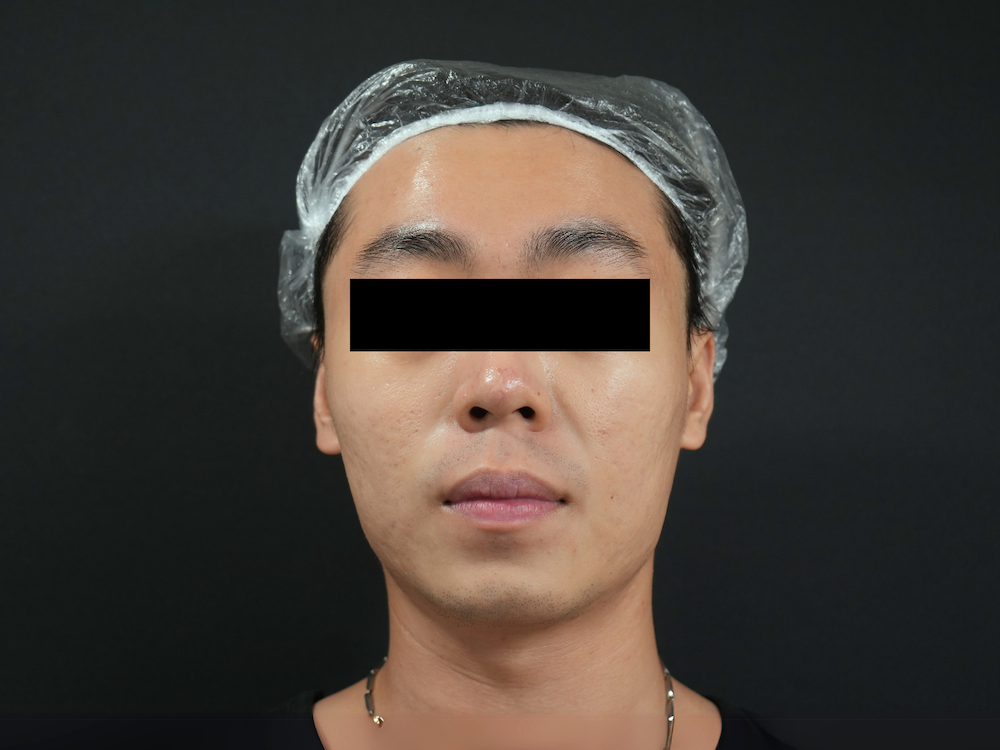 After image alt
