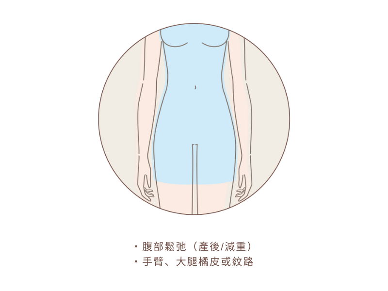 鳳凰電波｜適合打鳳凰電波類型