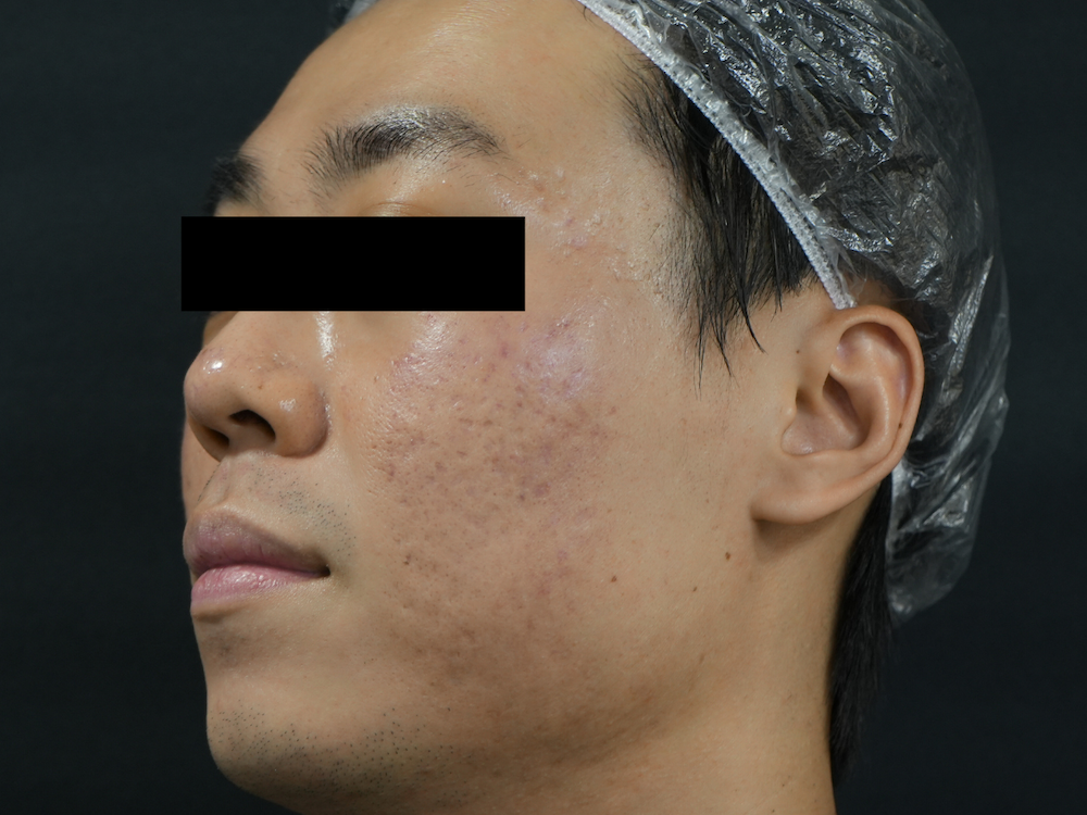 Before image alt