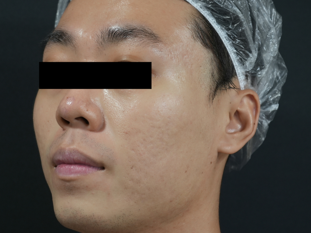 After image alt