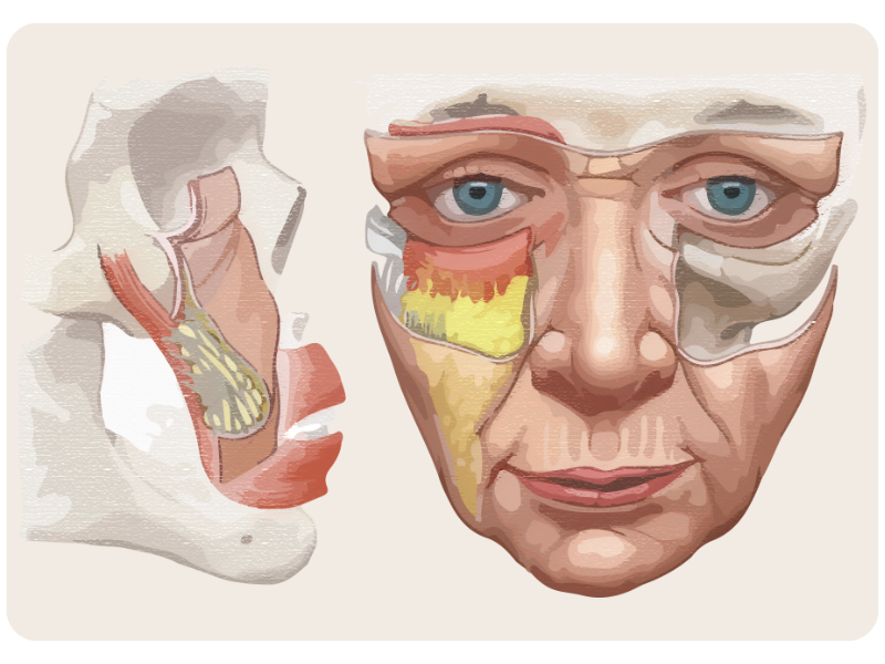 跨層次迴繞拉提｜中臉結構老化變化：從立體支撐到結構鬆垮_2