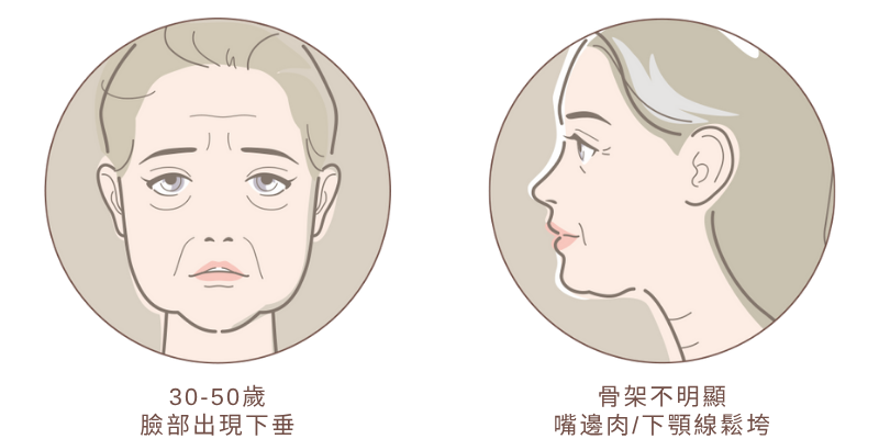 跨層次迴繞拉提｜跨層次迴繞拉提適合類型_1