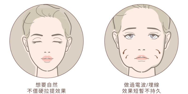 跨層次迴繞拉提｜跨層次迴繞拉提適合類型_2