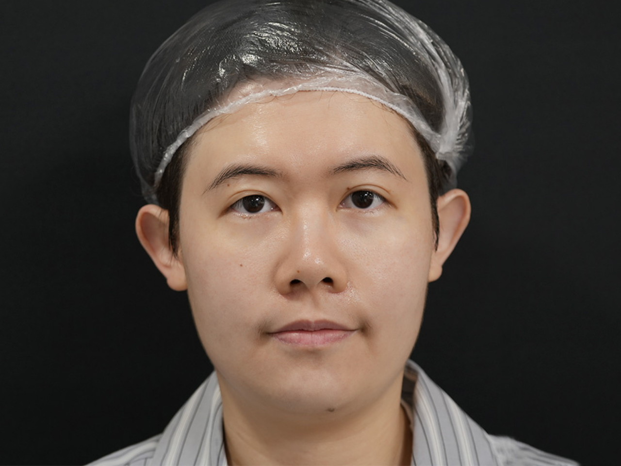Before image alt