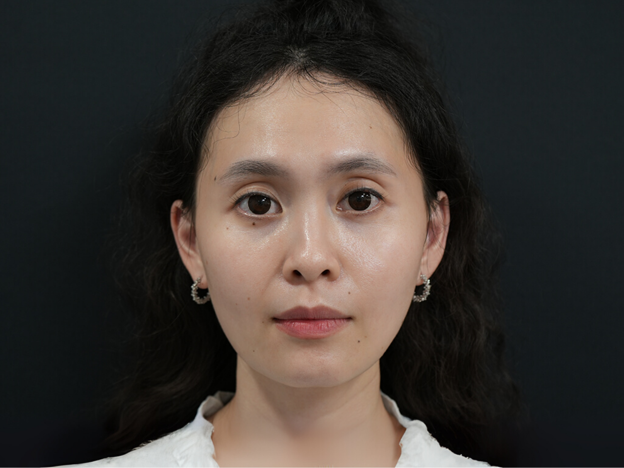 After image alt