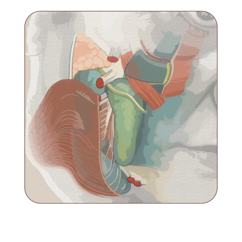 跨層次迴繞拉提｜下臉支撐鬆弛的根源 After