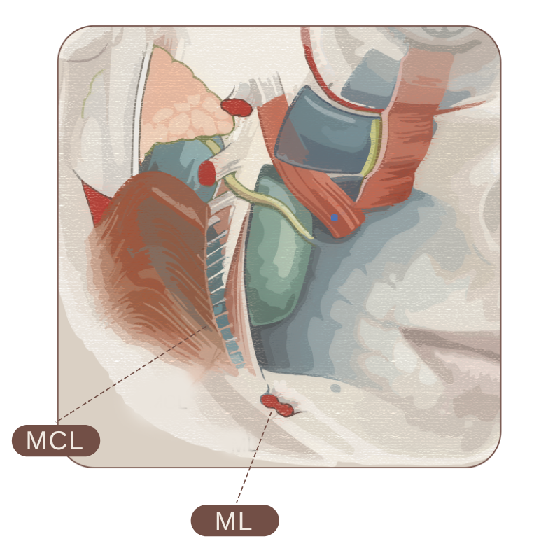 跨層次迴繞拉提｜下臉支撐鬆弛的根源Before