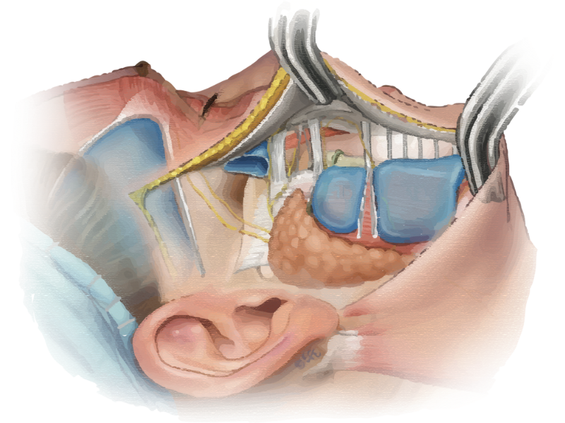 跨層次迴繞拉提｜下臉腔室特寫：破解嘴邊肉與輪廓鬆垮的深層關鍵