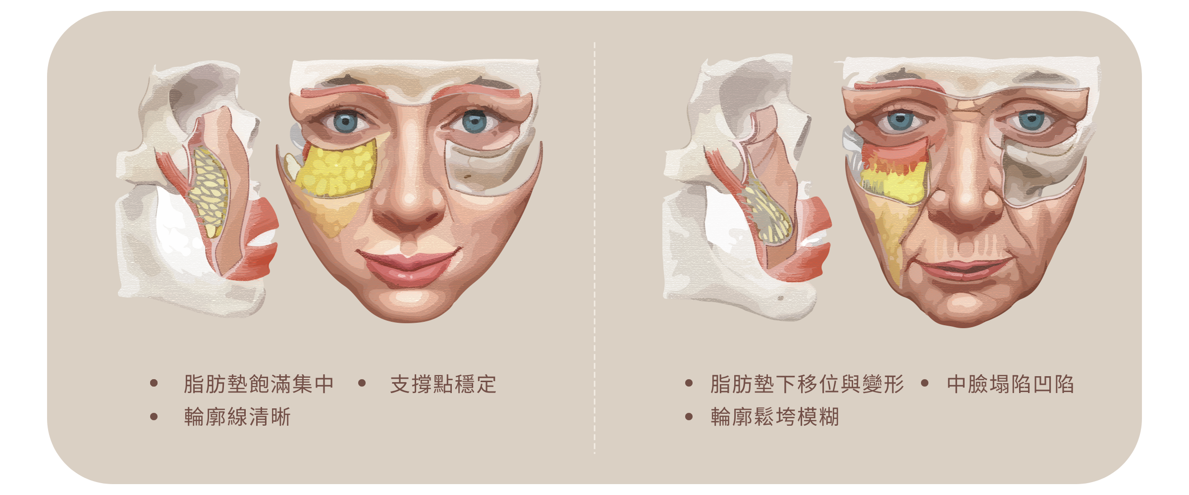 跨層次迴繞拉提｜中臉結構老化變化：從立體支撐到結構鬆垮