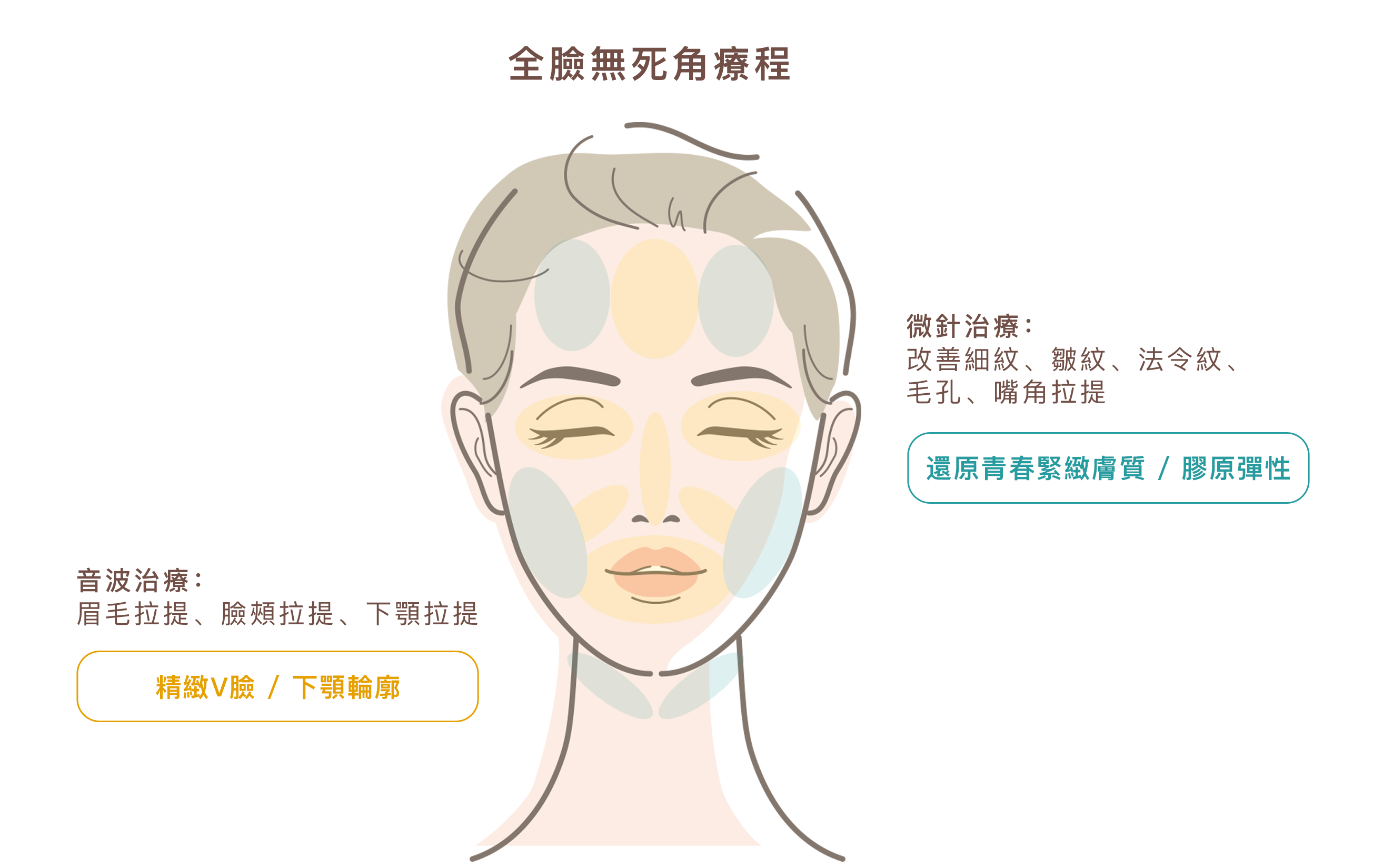 若有意同時接受閃電音波與閃電微針這兩種療程，建議可視個人肌膚狀況與需求，選擇「分次治療」的方式進行，讓每項療程都能發揮最佳效果，避免肌膚短時間內承受過多刺激。