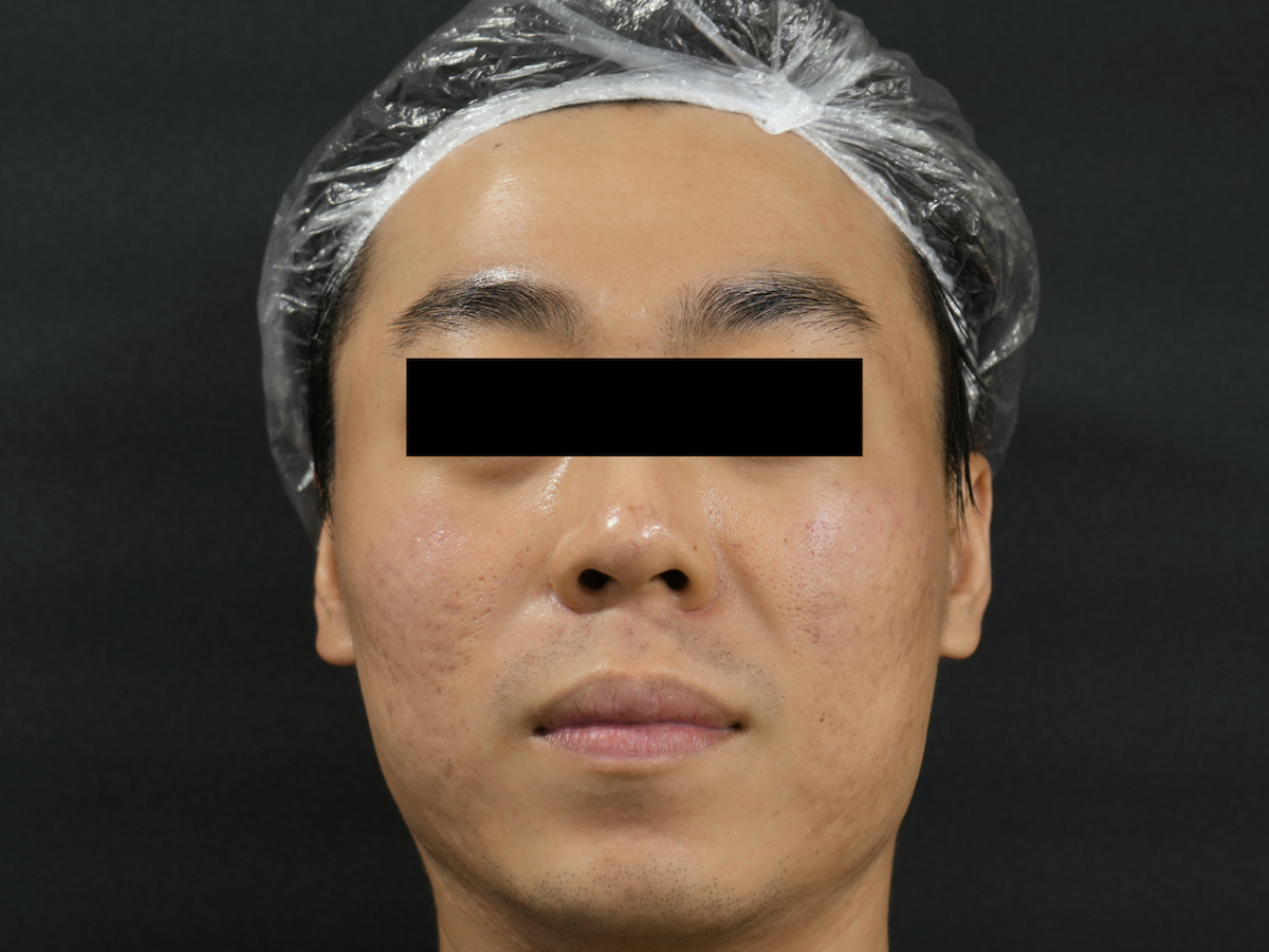 Before image alt
