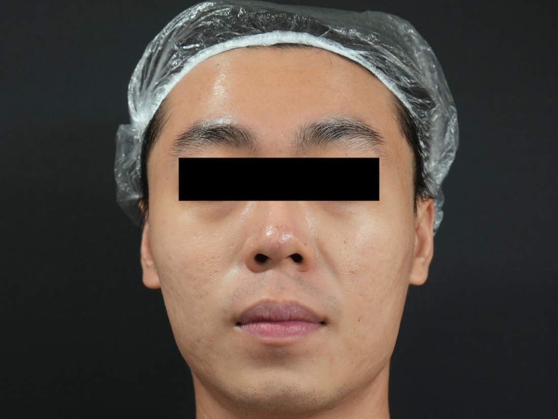 After image alt
