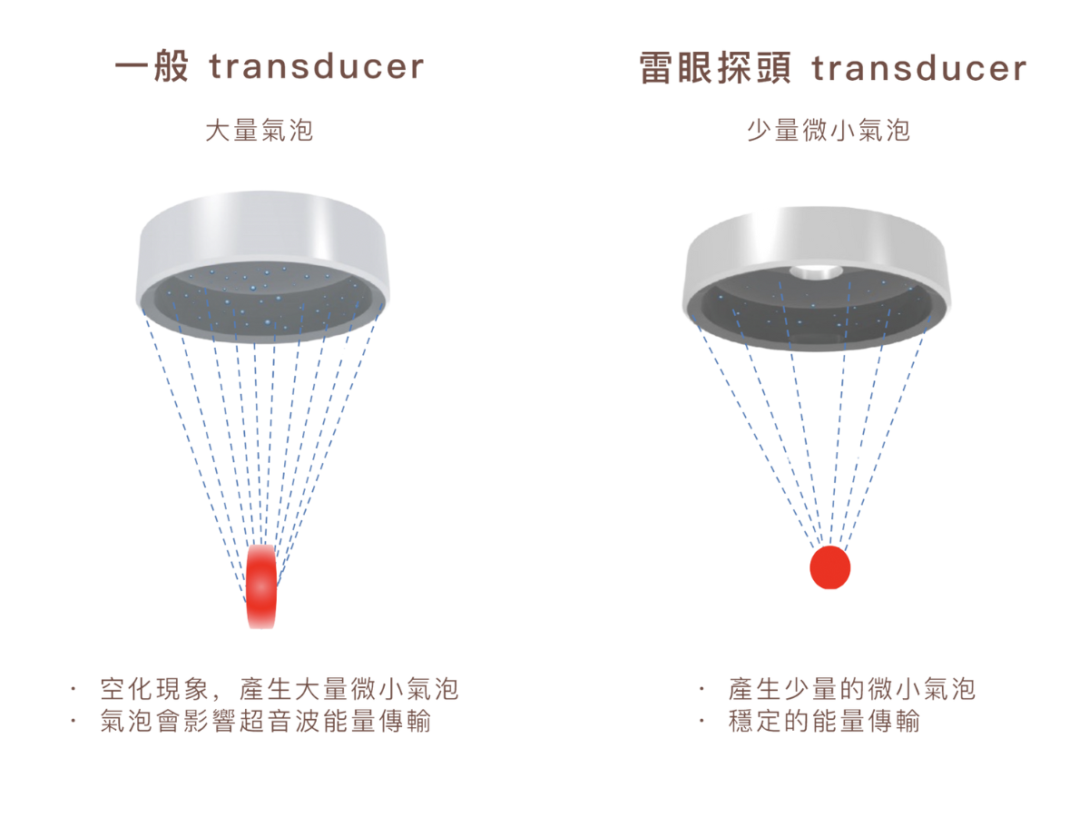 與傳統音波探頭相比，傳輸過程中常因為產生大量微小氣泡，導致能量輸出不穩定，不僅可能降低治療效果，也可能增加肌膚不適感與術後反應。而閃電音波所搭載的「環狀雷眼探頭」則大幅改良了這項問題。