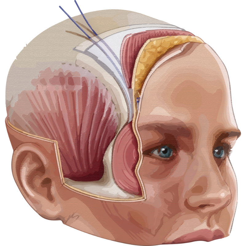 跨層次迴繞拉提｜深層支撐結構解析