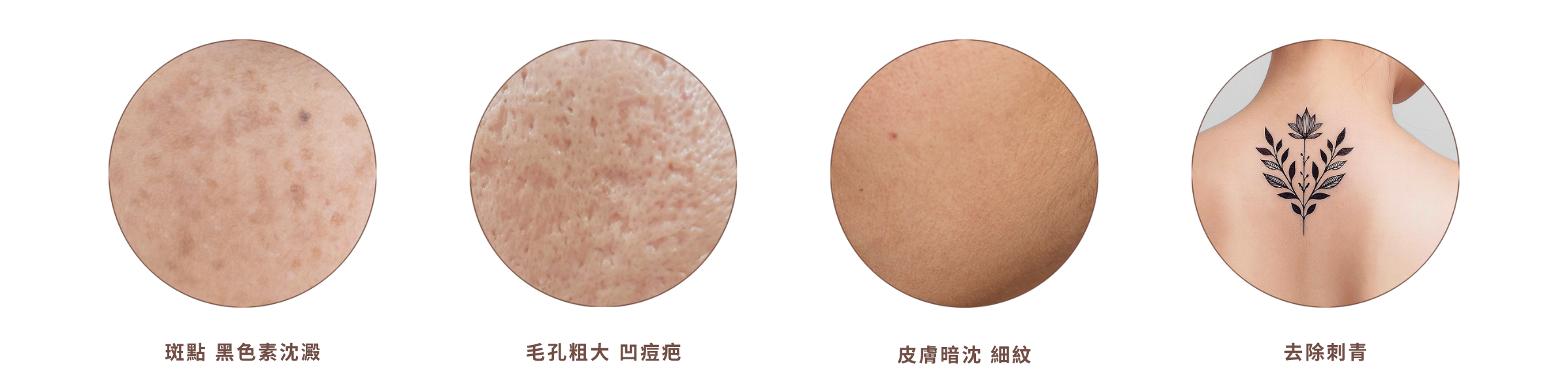 皮秒應對皮膚問題