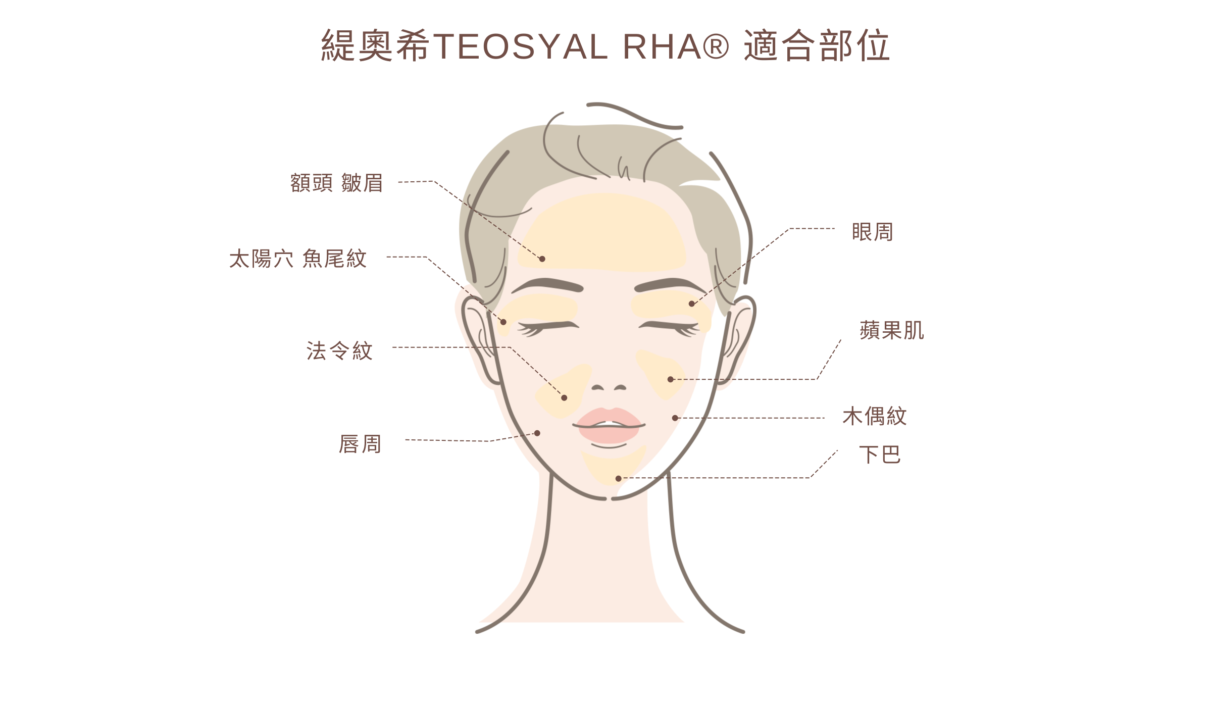 緹奧希TEOSYAL RHA® 適合施打部位