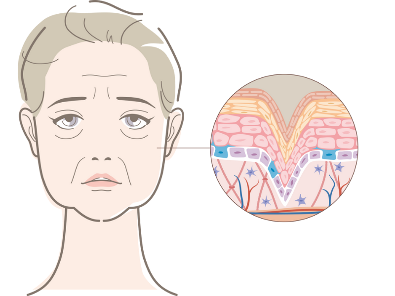 跨層次迴繞拉提｜導致輪廓鬆弛的四大關鍵因素