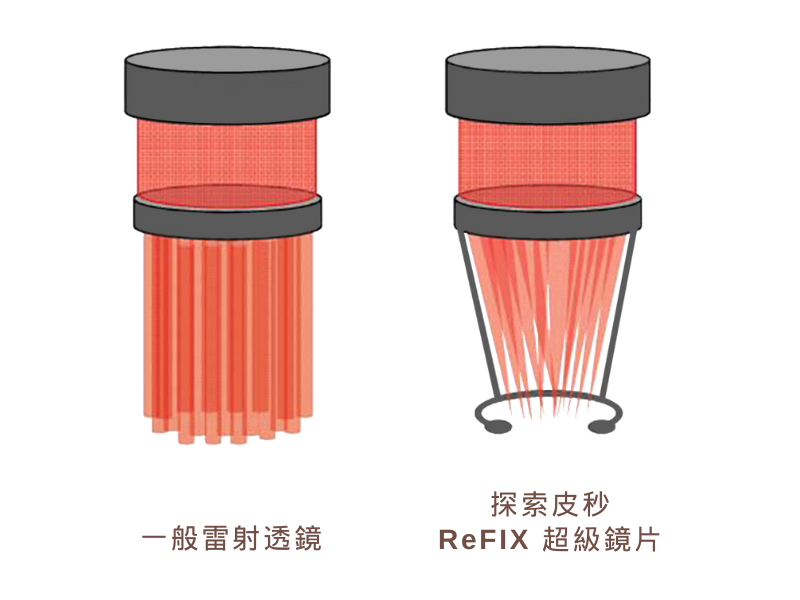 探索皮秒ReFIX超級鏡片與一般雷射透鏡