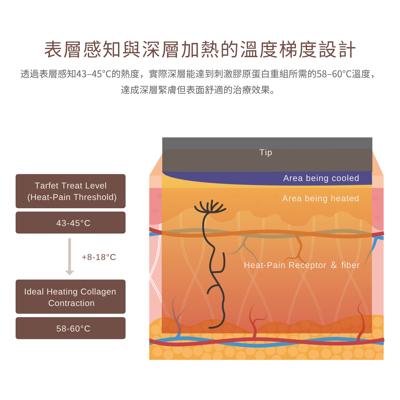 鳳凰電波｜治療溫度梯設計