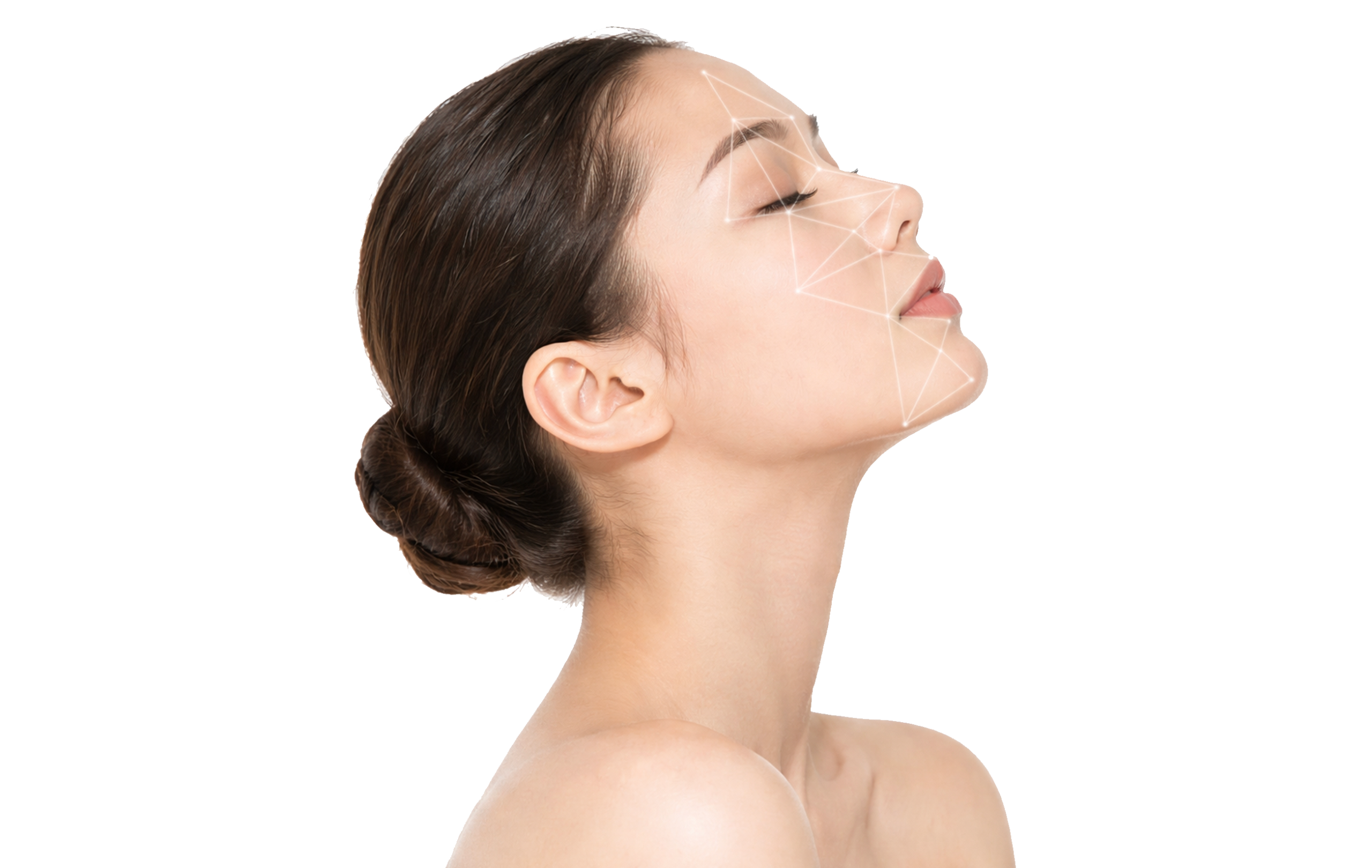 勤診所｜Vivacy 維法熙玻尿酸建議施打部位