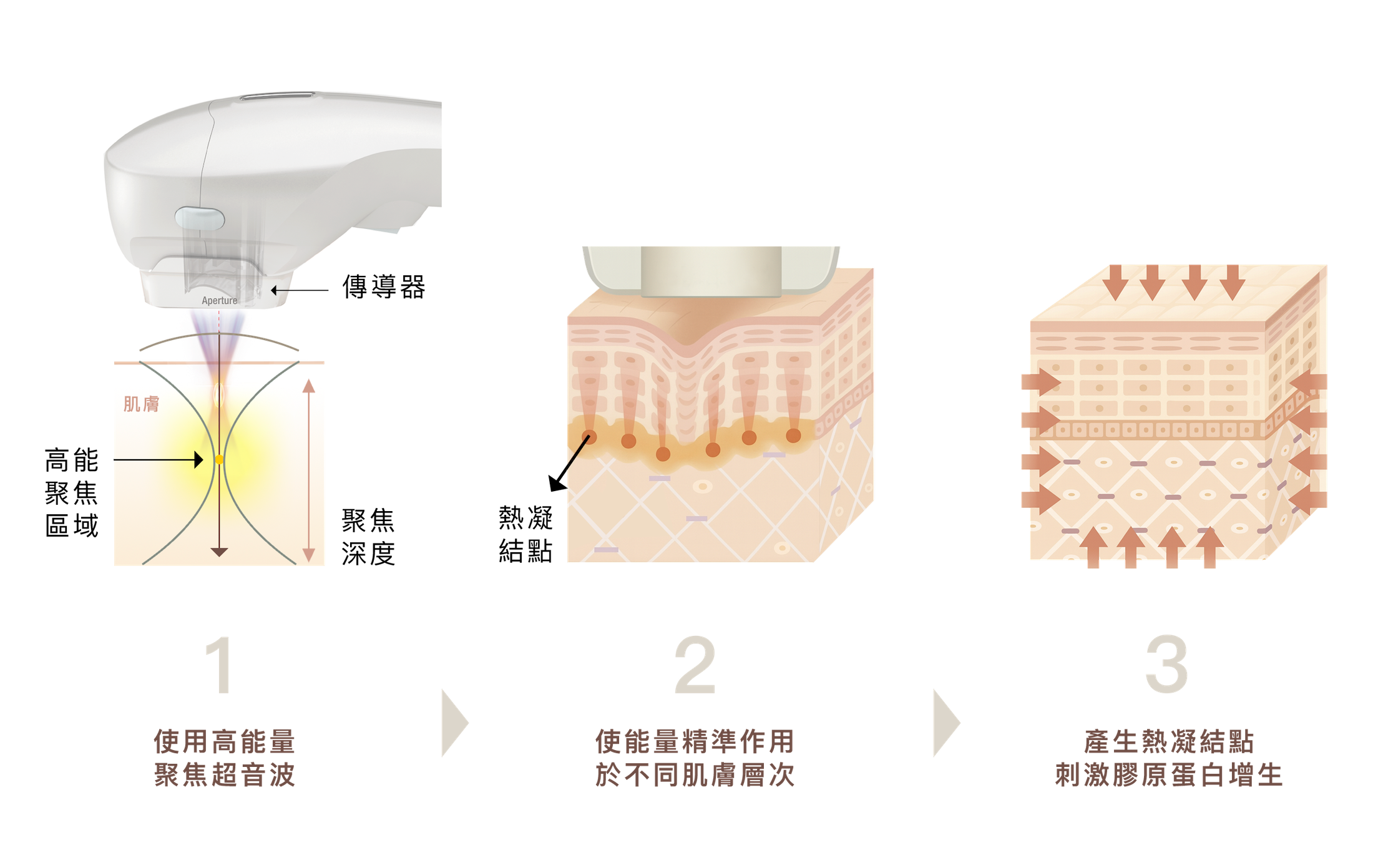 勤診所｜海芙音波原理