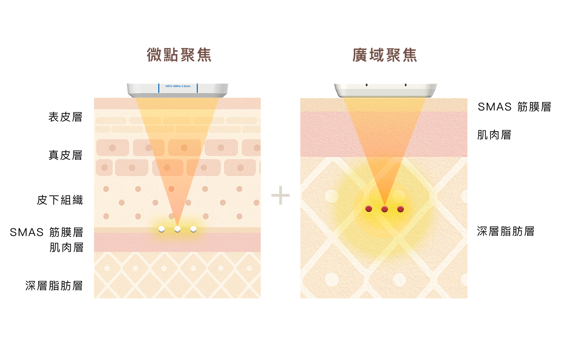 勤診所｜2重聚焦技術