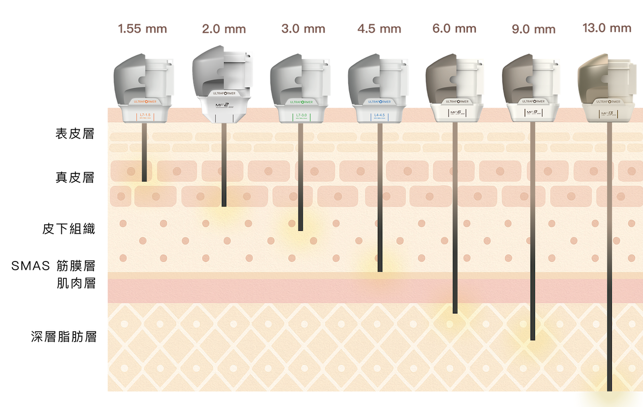 勤診所｜海芙音波 7段深層探頭配置