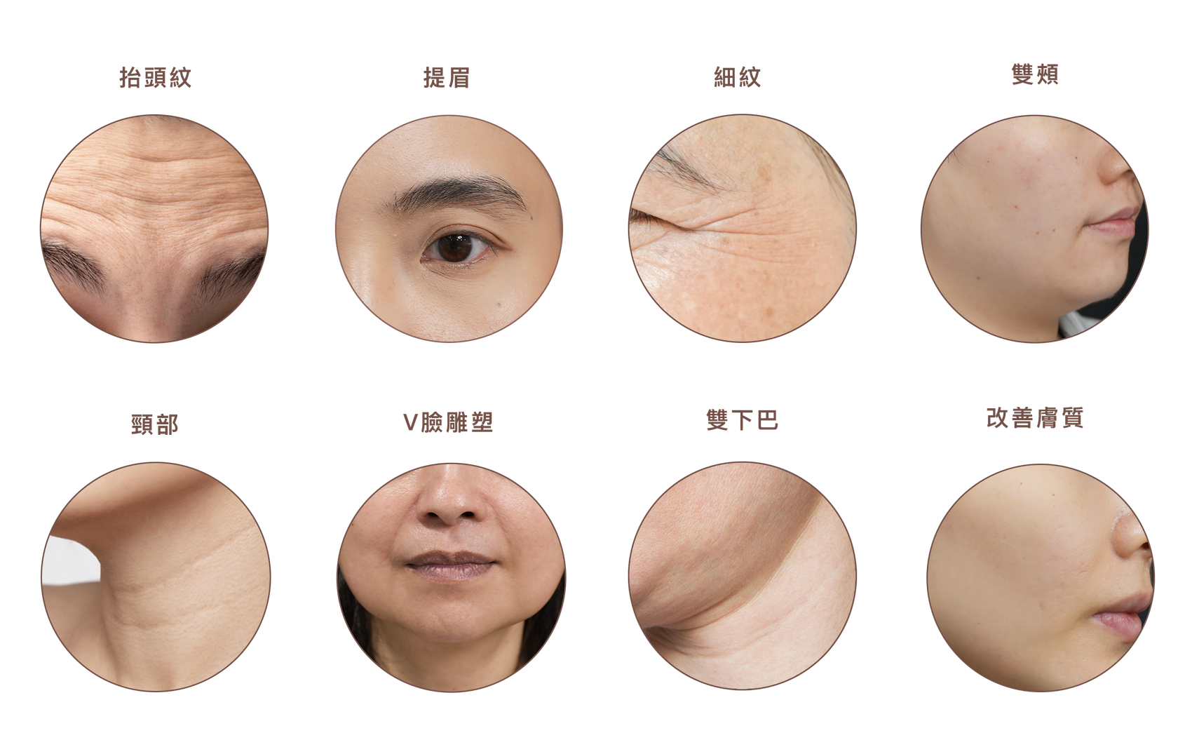 勤診所｜海芙音波適合部位