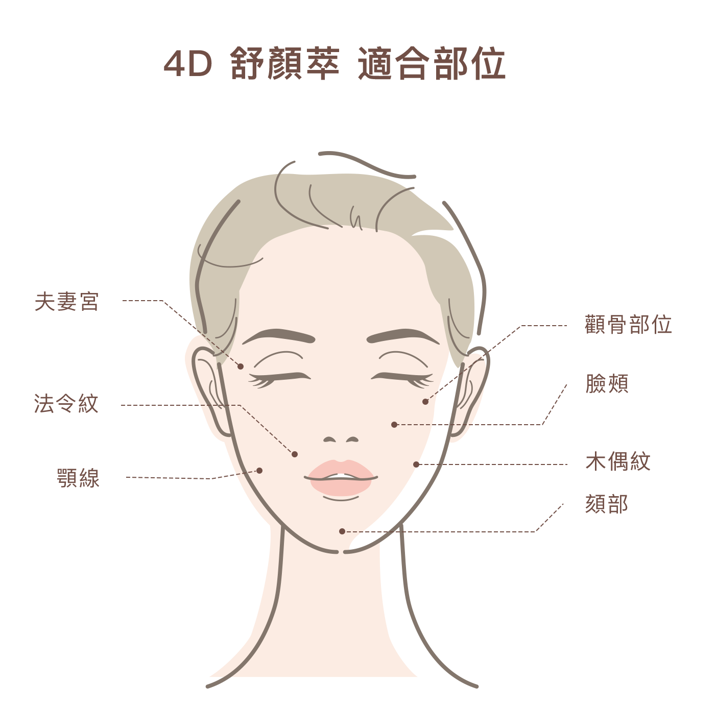 2：舒顏萃 (童妍針) 適合施打之部位