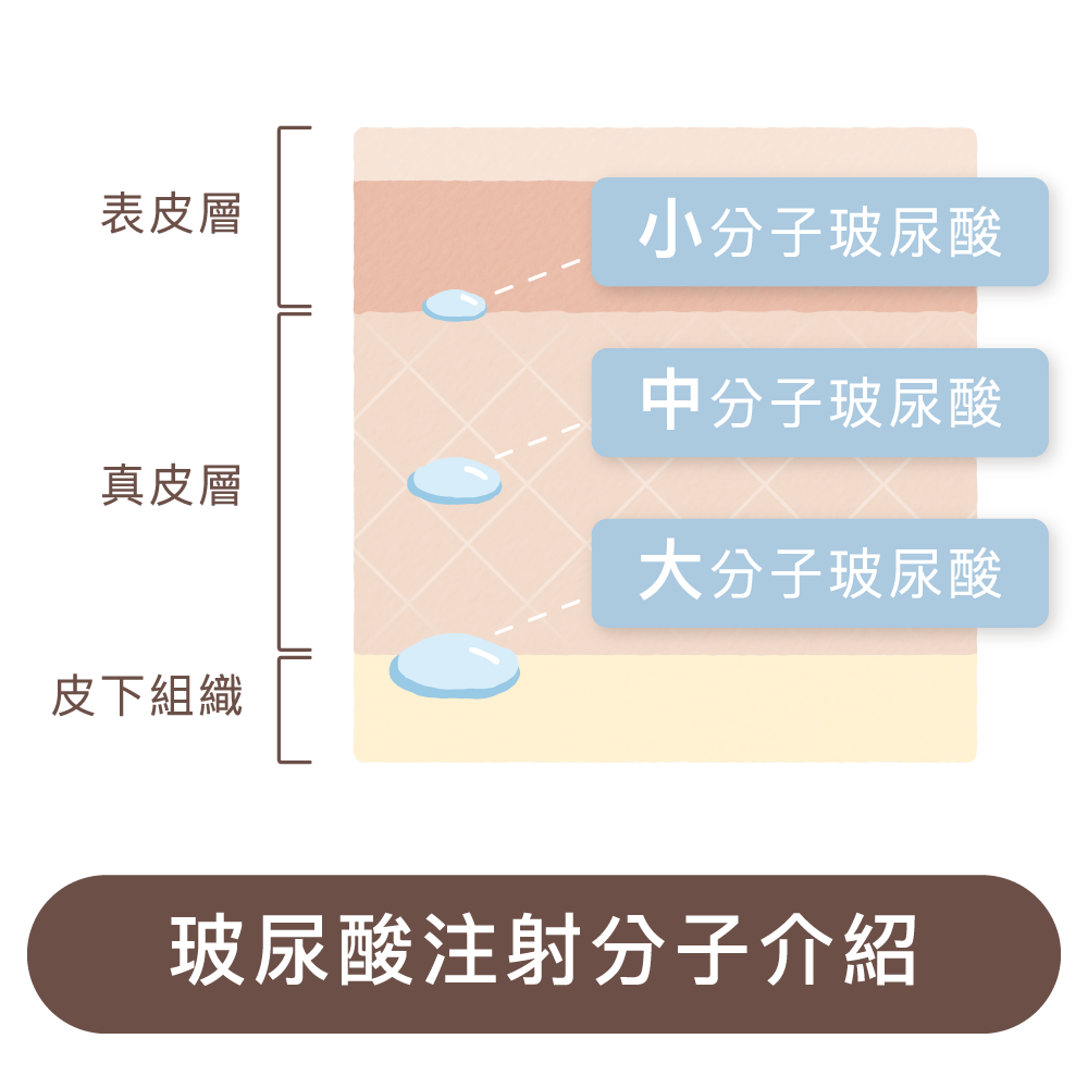 2603 瑞斯朗_五大優勢_2