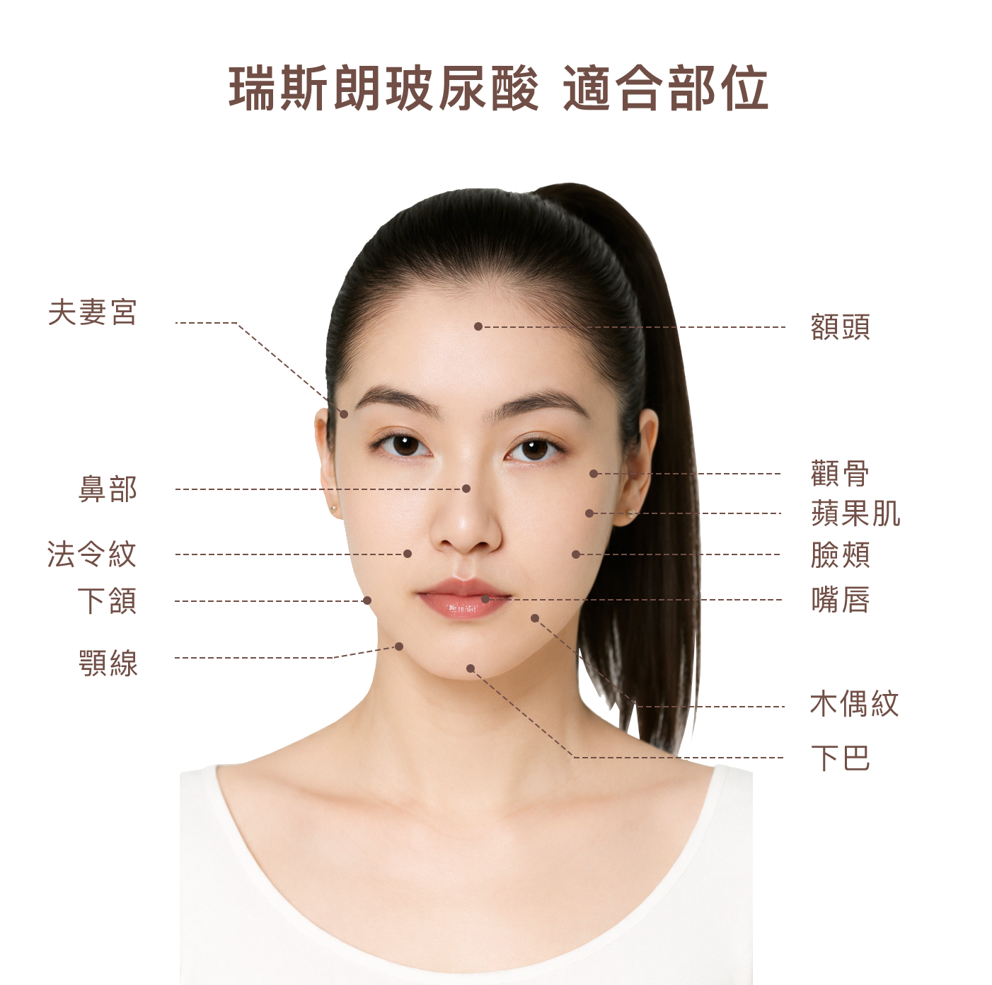 圖12 瑞斯朗玻尿酸 適合部位