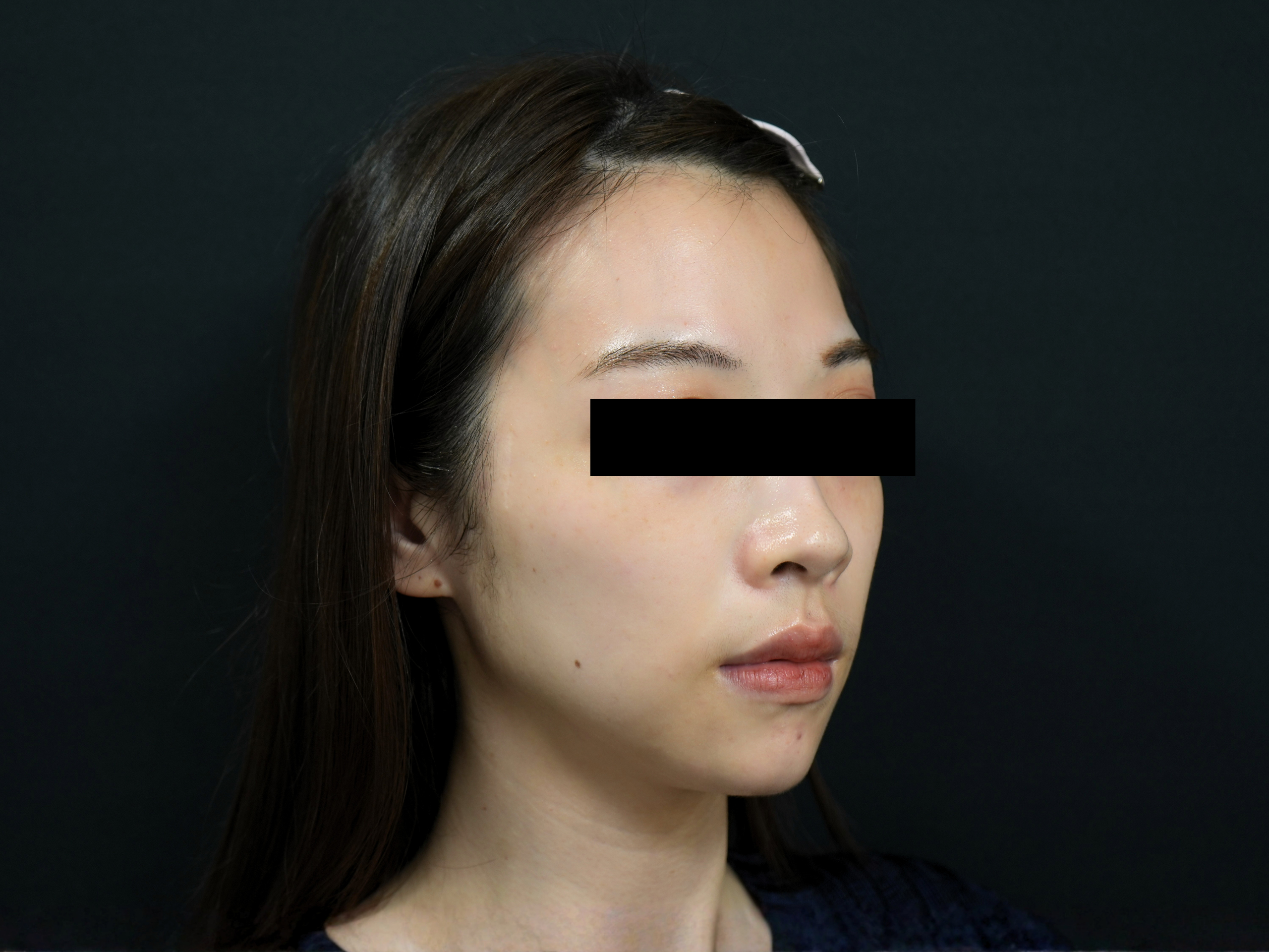 Before image alt