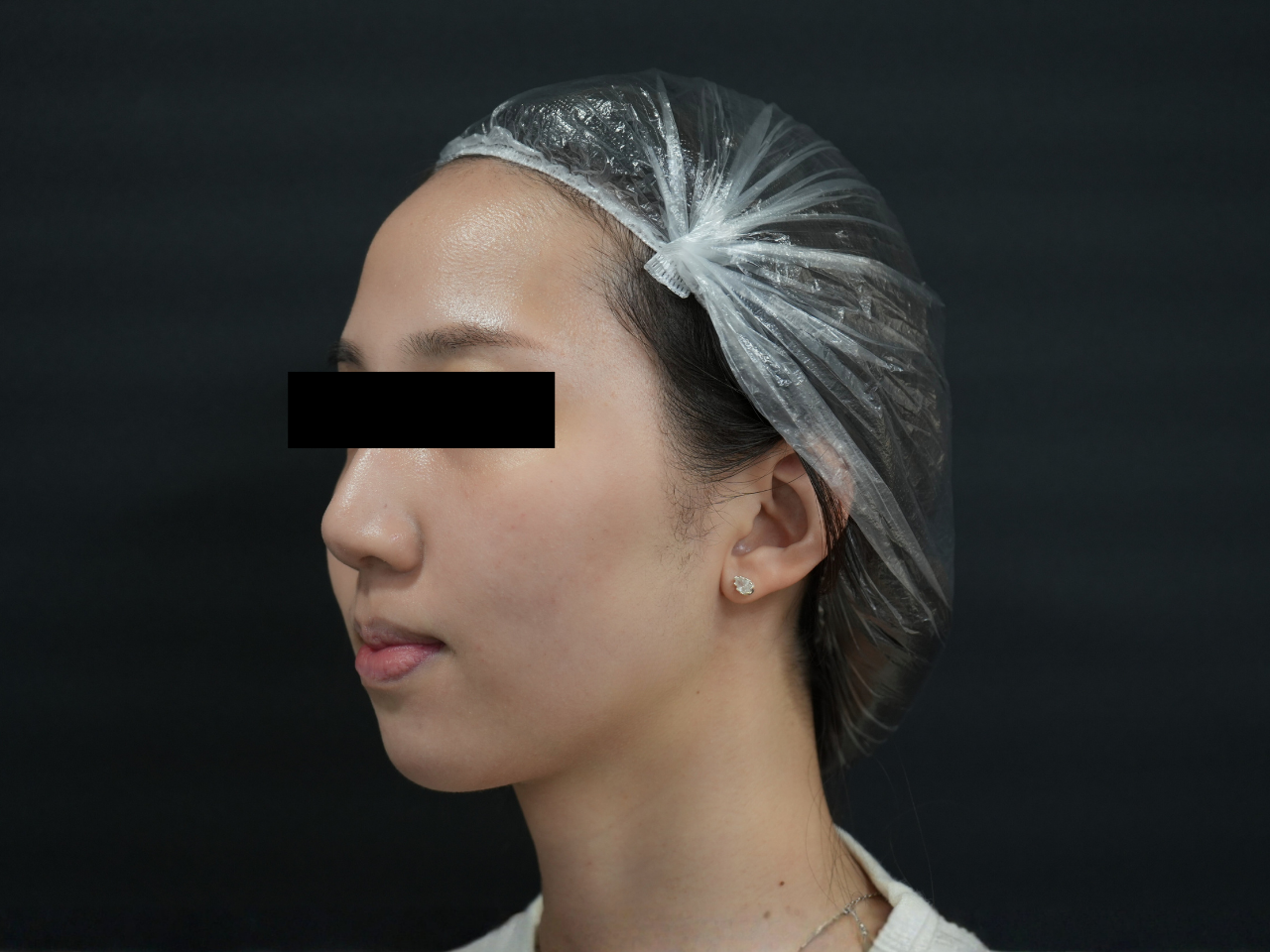 Before image alt