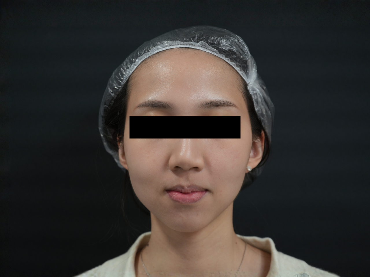 Before image alt