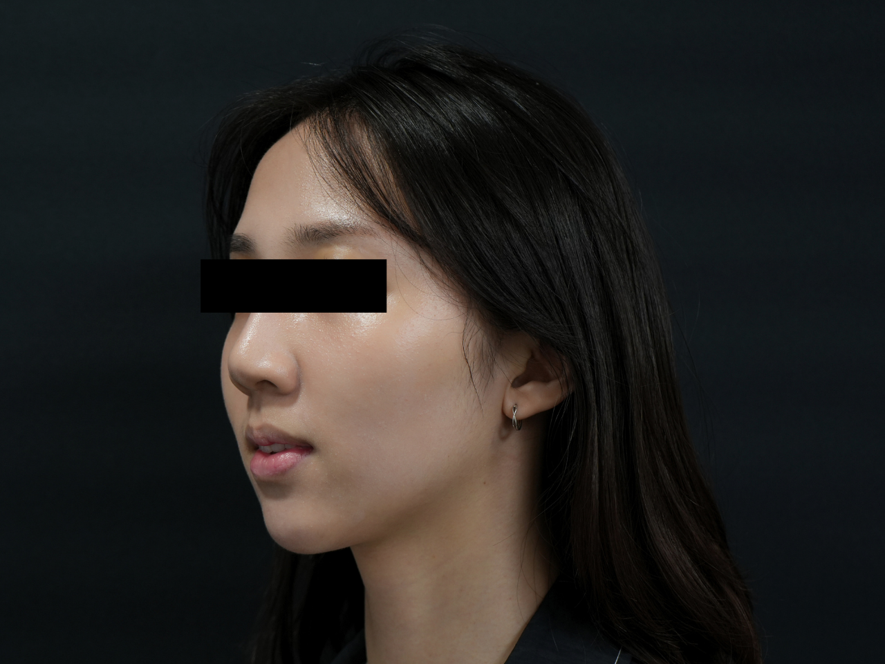 After image alt