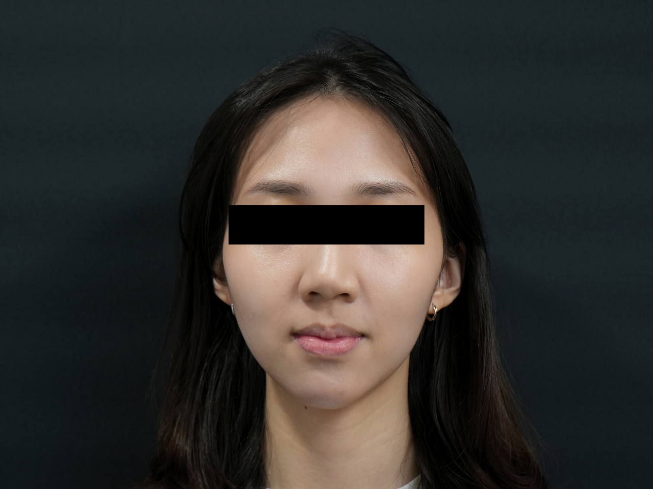 After image alt