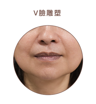 圖8-(1)6