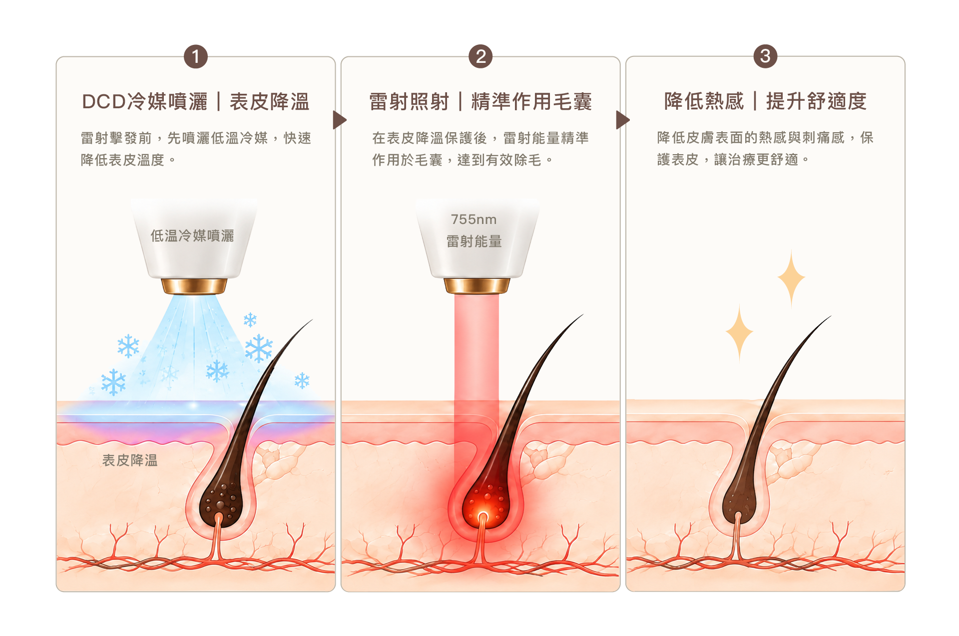 亞歷山大除毛療程DCD冷卻系統