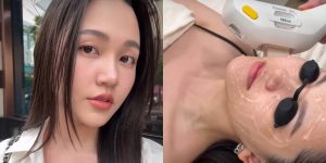 勤診所美麗見證｜海菲秀＋心動光，重要日程前快速無痛養膚